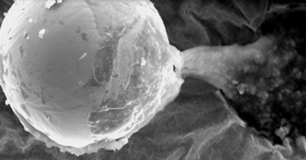 Aliens are splooging on Earth, but why?